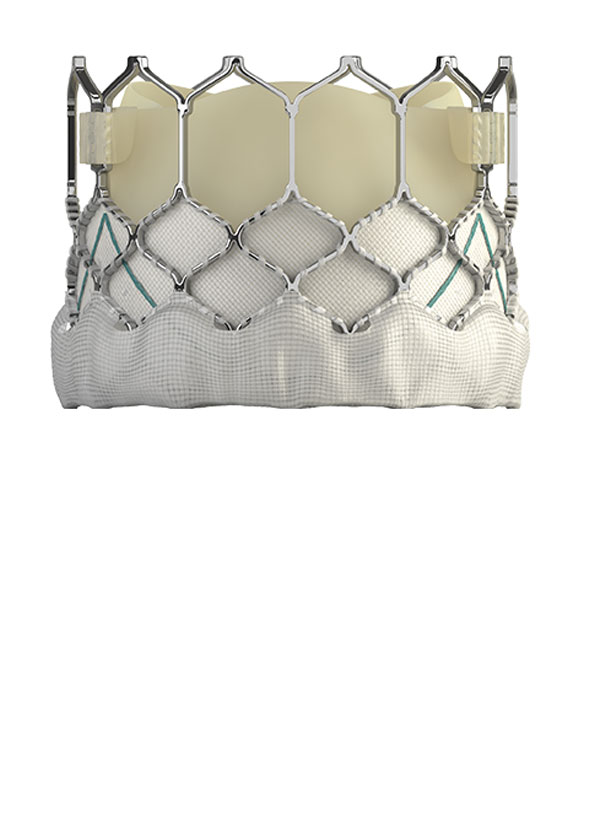 steelCage